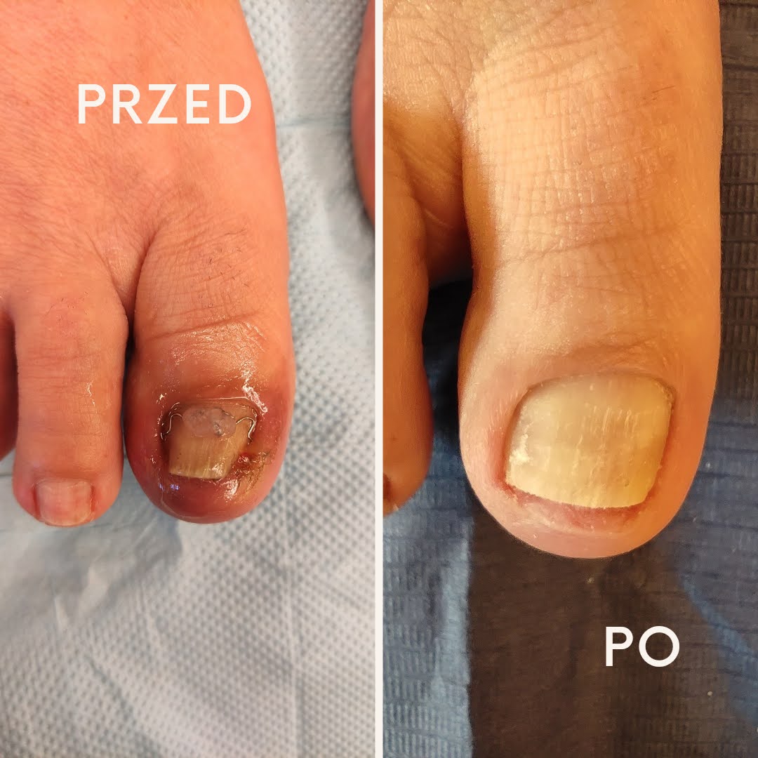 Before after minimal skincare Instagram post_20241004_170110_0000