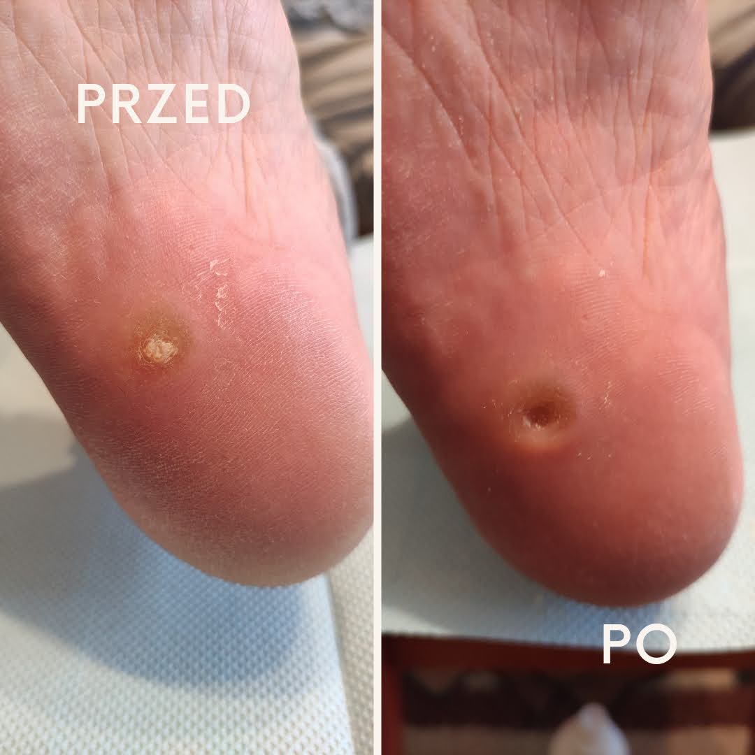 Before after minimal skincare Instagram post_20241004_170330_0000